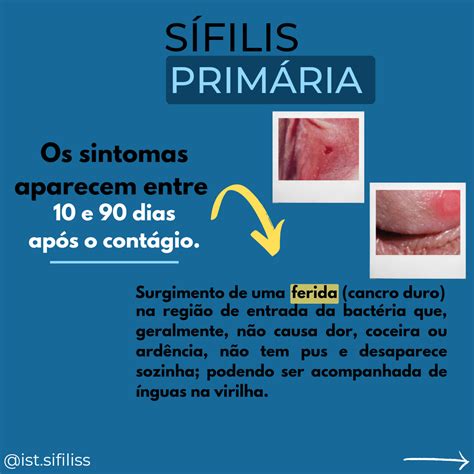 sifilis sintomas femininos-4